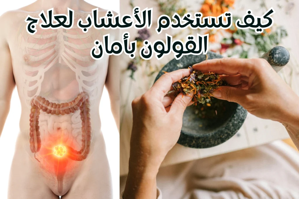 كيف-تستخدم-الأعشاب-لعلاج-القولون-بأمان